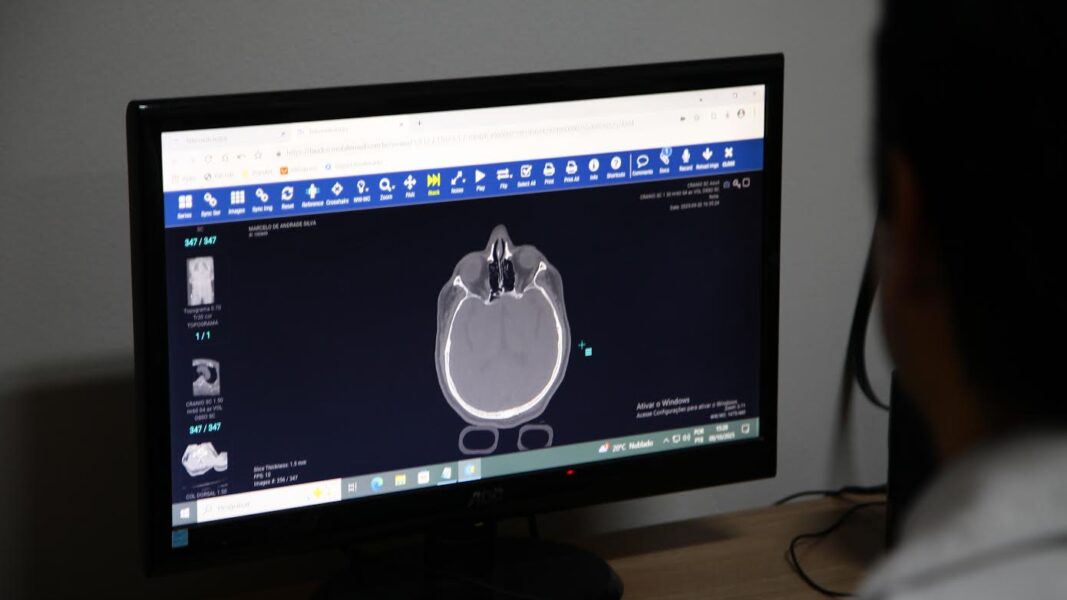 Cresce o número de vítimas de quedas atendidas no Hospital Geral de Nova Iguaçu