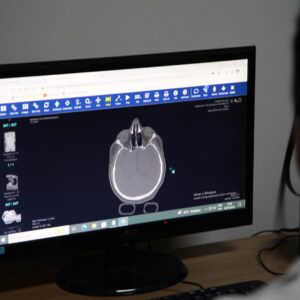 Cresce o número de vítimas de quedas atendidas no Hospital Geral de Nova Iguaçu