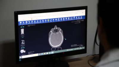 Cresce o número de vítimas de quedas atendidas no Hospital Geral de Nova Iguaçu